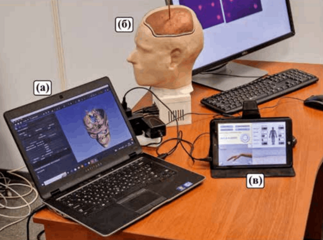 Молодые учёные СПбГУТ представили возможности протокола OpenIGTLink для нейрохирургов